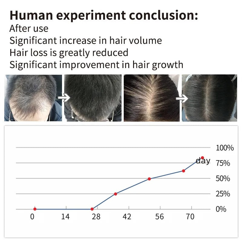 Hair Root Eyelash Growth Liquid Hair Growth Hair Renewal Liquid